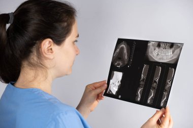 Doktor, temporomandibular eklem bozukluğu ve maloksiyonu olan bir hastanın tomografisini tutuyor.