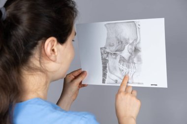 Doktor, temporomandibular eklem bozukluğu ve maloksiyonu olan bir hastanın tomografisini tutuyor.