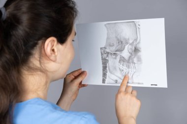 The doctor holds a CT scan of a patient with temporomandibular joint dysfunction and malocclusion clipart