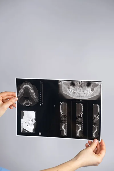 Der Arzt Hält Eine Aufnahme Eines Patienten Mit Kiefergelenkdysfunktion Und — Stockfoto