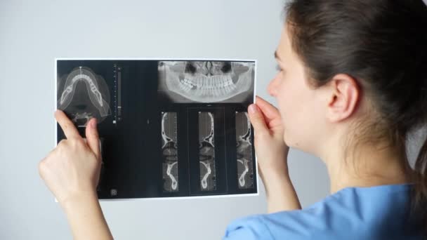 Doktor Temporomandibular Eklem Bozukluğu Maloksiyonlu Bir Hastanın Tomografisini Gösteriyor — Stok video