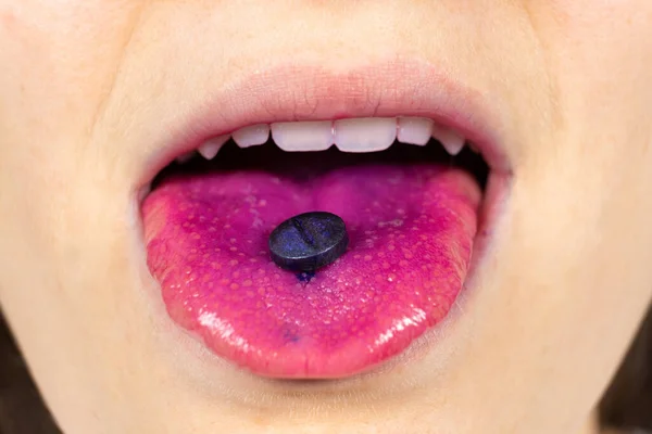 Eine Person Zeigt Eine Indikator Pille Auf Der Zunge Plaque Stockbild