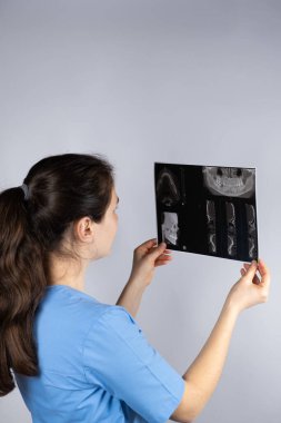 Doktor, temporomandibular eklem bozukluğu ve maloksiyonu olan bir hastanın tomografisini tutuyor.