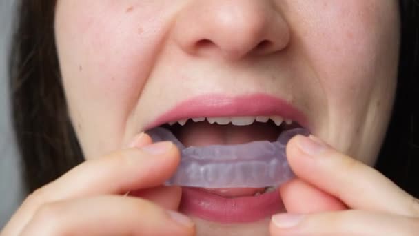 Γυναίκα Βάζει Στο Στόμα Της Οδοντικό Προστατευτικό Νάρθηκα Για Θεραπεία — Αρχείο Βίντεο