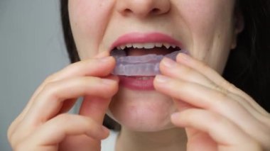 Kadın diş koruyucusunu ağzına koyar, temporomandibular eklemlerin işlev bozukluğunun tedavisi için atel atar, bruksisizm, maloklasyon, çene kaslarını gevşetmek için.