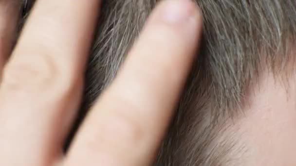Ένας Γκριζομάλλης Δείχνει Γκρίζα Μαλλιά Στους Κροτάφους Του Φροντίδα Μαλλιών — Αρχείο Βίντεο
