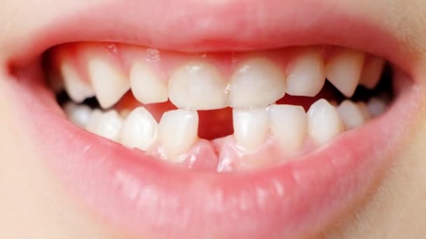 Ztráta Mléčných Zubů Dětí Šestileté Dítě Ukazuje První Dětský Zub — Stock video