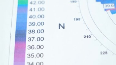 Keratoconus 'lu bir hastada korneanın kalınlığı ve eğriliğinin incelenmesinin sonuçları.