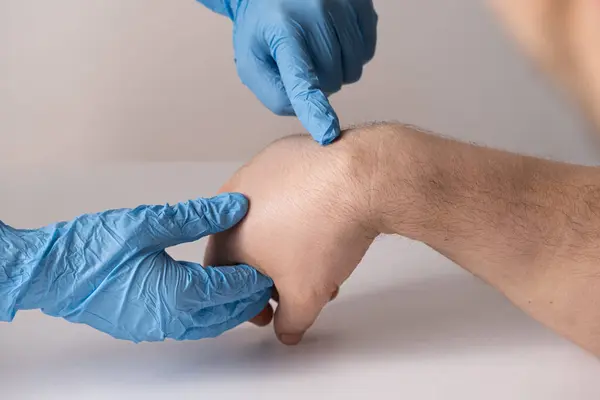 Erkek bir hastada bilek kisti ya da higroma, bir doktor tarafından muayene..