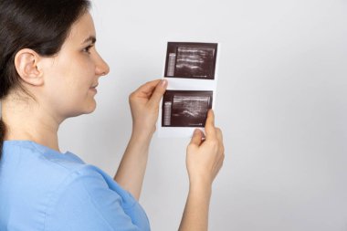 Doktor tiroid bezinde küçük nodülleri olan bir hastanın ultrasonunun sonuçlarını tutuyor..