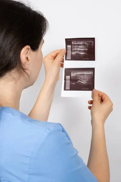 stock image The doctor holds the results of an ultrasound of the thyroid gland of a patient with small nodules in the thyroid gland.