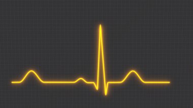 Sağlıklı bir insanın kalp ritmi EKG elektrokardiyogramı, kalp muayene yöntemi..