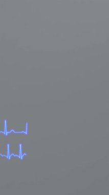 Kalp ritmi ve taşikardi EKG 'si karşılaştırması.
