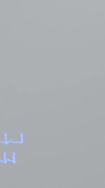 EKG grafikleri kalp ritmi ve aritminin normal olduğunu gösteriyor..