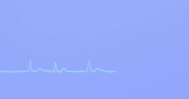 Atriyal fibrilasyon EKG grafiği, 3D canlandırma.