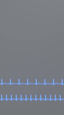 Kalp ritmi ve taşikardi EKG 'si karşılaştırması.
