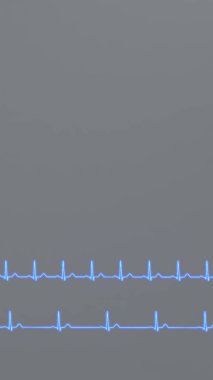 Kalp ritmi ve bradikardi EKG 'si karşılaştırması.