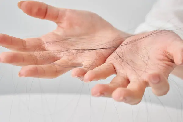 Hand Woman Lost Hair White Background — Stock Photo, Image