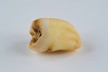 Çıkarılmış diş orijinal halinde ve beyaz arka planda