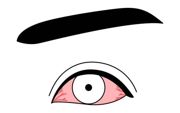 Clipart Médico Ilustração Desenho Linha Doença Ocular Conjuntivite Ilustração Vetorial —  Vetores de Stock
