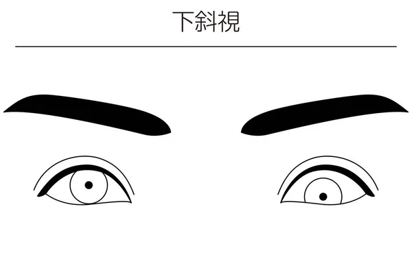 Ilustracje Medyczne Schematyczne Rysunki Linii Chorób Oczu Zez Hipotropia Tłumaczenie — Wektor stockowy