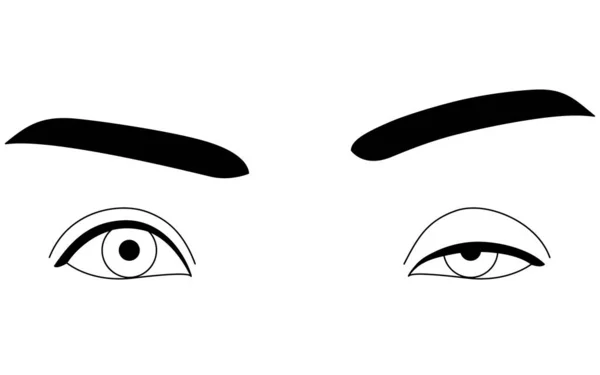 Diagram Severe Ptosis Eyelid Drooping Vector Illustration — 스톡 벡터
