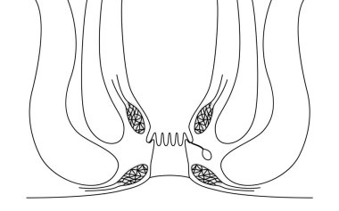 Human body rectum and anus area Illustrations, cross sectional view, Vector Illustration