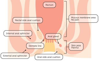 Human body rectum and anus area Illustrations, cross sectional view - Translation: Rectum, anal cushion, sphincter, mucous membrane area, skin area