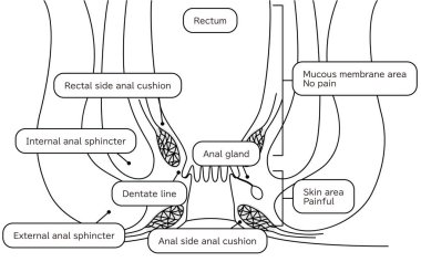 Human body rectum and anus area Illustrations, cross sectional view - Translation: Rectum, anal cushion, sphincter, mucous membrane area, skin area