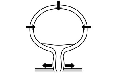 Normal mesanenin tıbbi örnekleri, nasıl işediği ve nasıl işediği, Vektör İllüzyonu