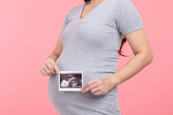 Happy Pregnant Woman Standing Smile Holding Ultrasound Image Stroking Big — Stockfoto