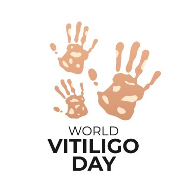 Dünya Vitiligo Günü 'nün vektör grafiği Dünya Vitiligo Günü için ideal.