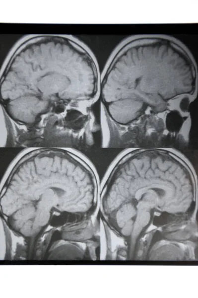 Macrophoto of computer tomography with the brain. Medical, scientific and educational MRI of the brain. Magnetic resonance imaging