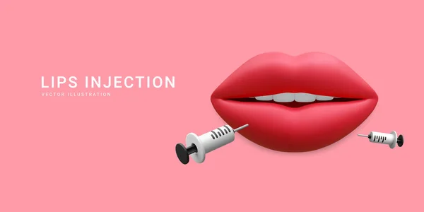 Banner Realista Para Inyección Labios Concepto Dermatología Tratamiento Cosmetológico Rojo — Vector de stock