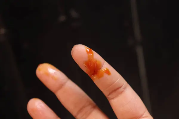 Yaralı ve karanlık geçmişi olan birinin elleri.