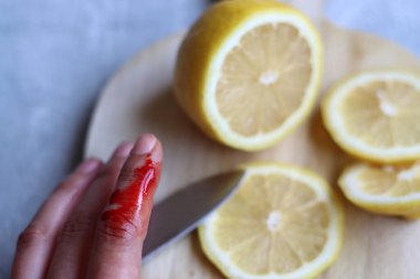 Kadın kazara parmağını kesti. Kadının elinde gerçek kan var. Dişi eller, gri arka planda tahta bir tahtada limon kesiyor ve yazı yazmak için yer açıyor.