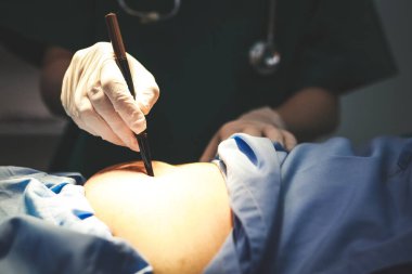 Bir kadın cerrah ameliyat için bir kadının derisini işaretlemek için bir kalem kullanır. Hastanelerde tıbbi hizmetler