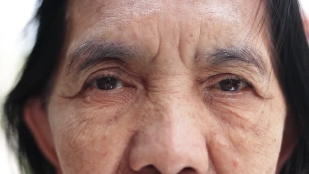 Viso Occhi Anziana Asiatica Che Guarda Telecamera Degenerazione Malattie Oculari — Video Stock