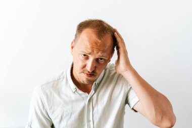 Saç dökülme problemleri yüzünden depresyonda olan üzgün, kel bir adam sinirli ve sinirli görünüyor ve kafasını tutuyor. Saç naklinden önce.