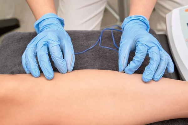 stock image  Therapeutic electroacupuncture treatment by skilled physiotherapist