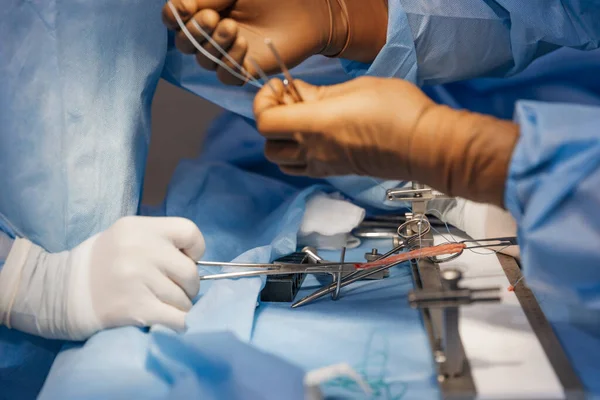 Surgeons Work Cut Part Knee Joint Muscular Ligament Arthroscopic Anterior — Stock Photo, Image
