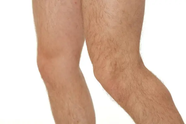 Male Legs Close White Studio Background Knee — Stock Photo, Image