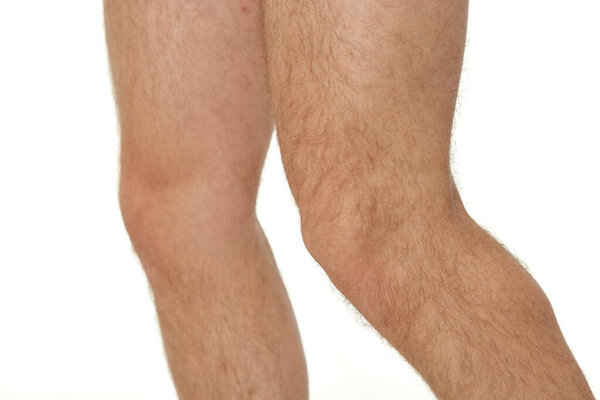 male legs close up on white studio background. knee
