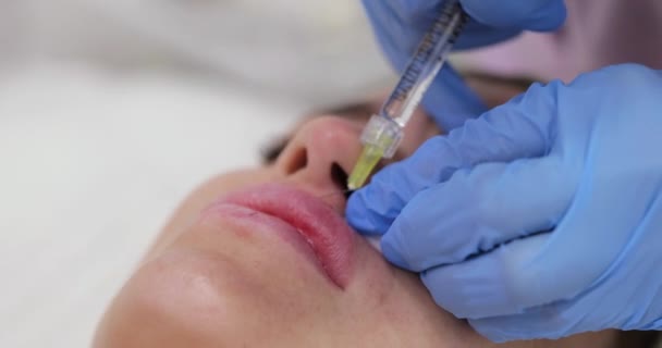 Kosmetolog Gör Injektioner För Att Förstora Läpparna Vacker Kvinna Förfarande — Stockvideo