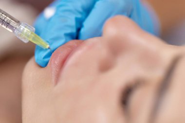 Kozmetik uzmanı güzel bir kadının dudaklarını büyütmek için iğneler yapar. Prosedür dudak büyütme