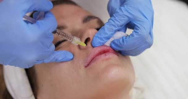Kosmetolog Wykonuje Zastrzyki Aby Powiększyć Usta Pięknej Kobiety Zabieg Powiększenie — Wideo stockowe