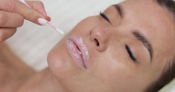 Kosmetyczka Nakłada Krem Znieczulający Usta Kobiety Przed Wstrzyknięciem Kwasu Hialuronowego — Wideo stockowe