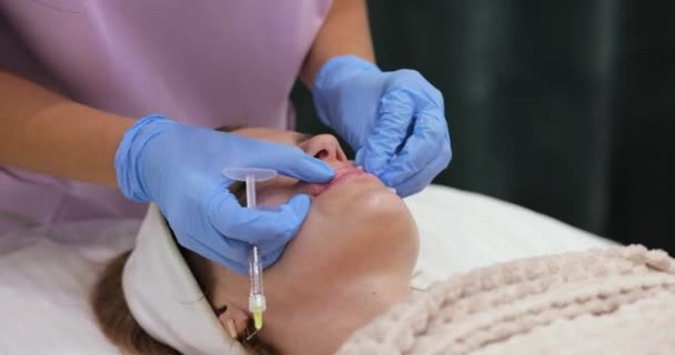 Cosmetoloog Maakt Injecties Lippen Van Een Mooie Vrouw Vergroten Ingreep — Stockvideo