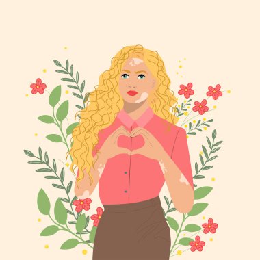 Vitiligo kadın kalp şeklinde hareket gösteriyor. Vitiligo ve kendini sevme kavramı. Vektör illüstrasyonu