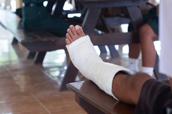 Legs in casts injured in accidents. Injuries of students in the school.